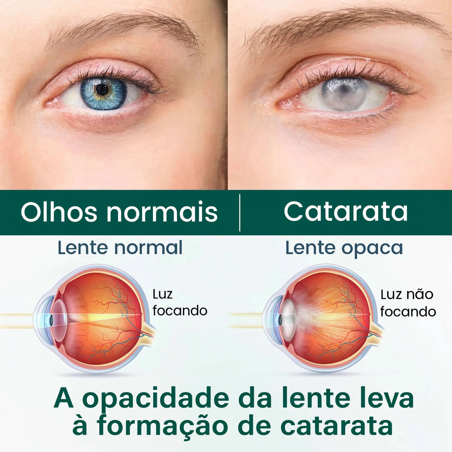 Sheylla OptiClear