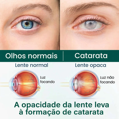 Sheylla OptiClear
