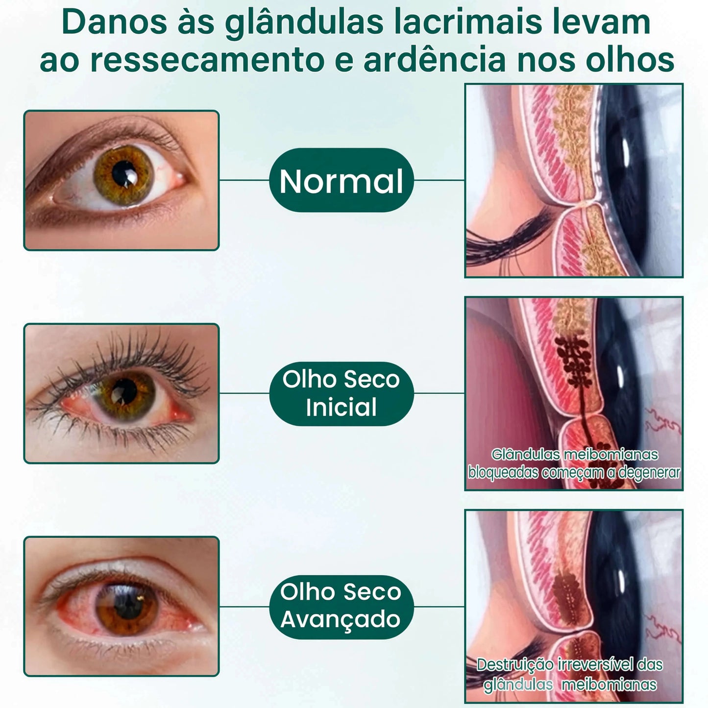 Sheylla OptiClear