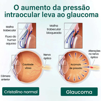 Sheylla OptiClear